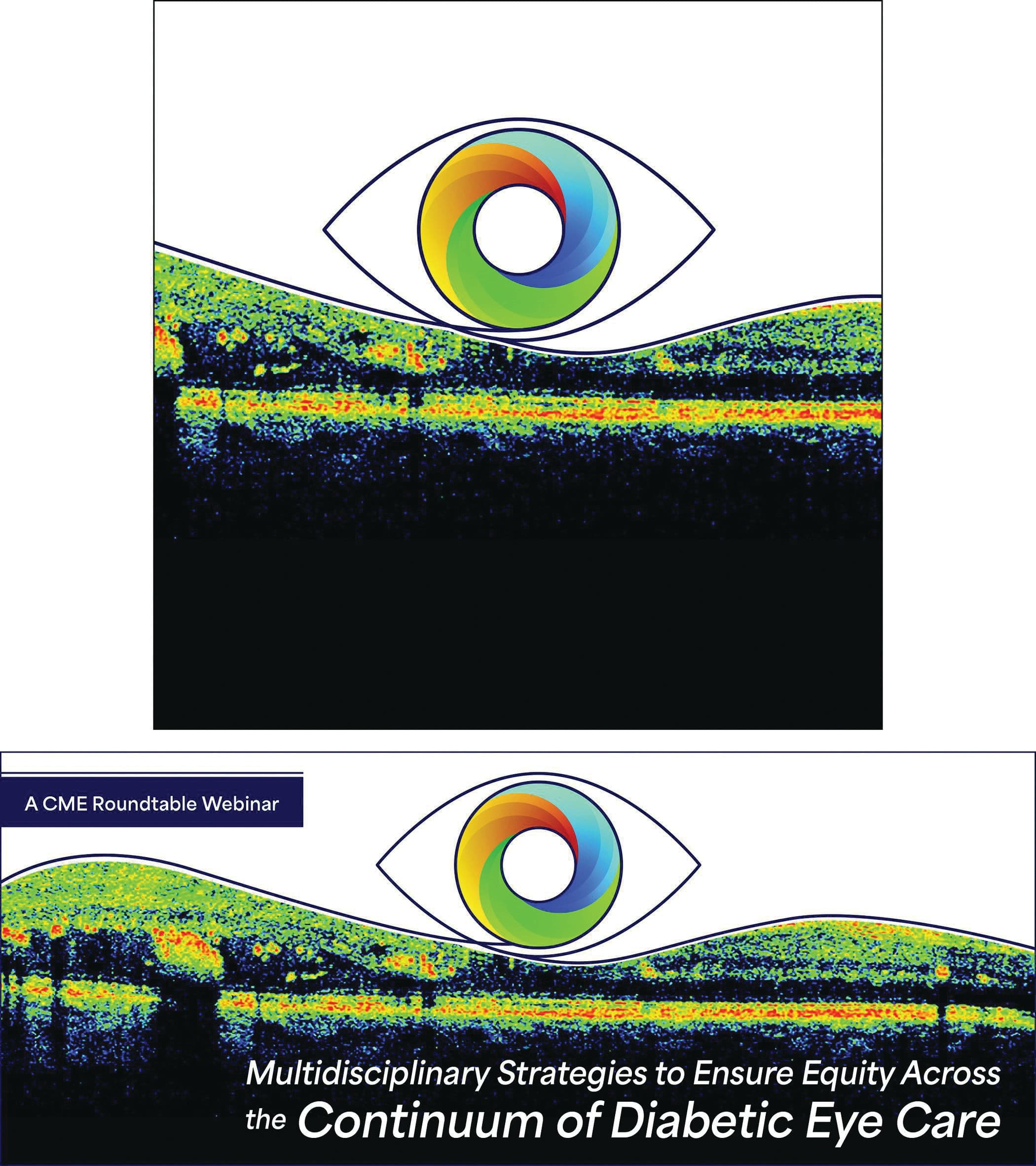 Continuum Eye Webinar Banner