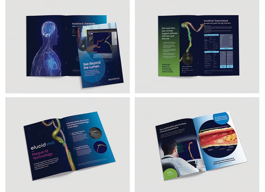 ElucidVivo Brochure - See Beyond The Lumen