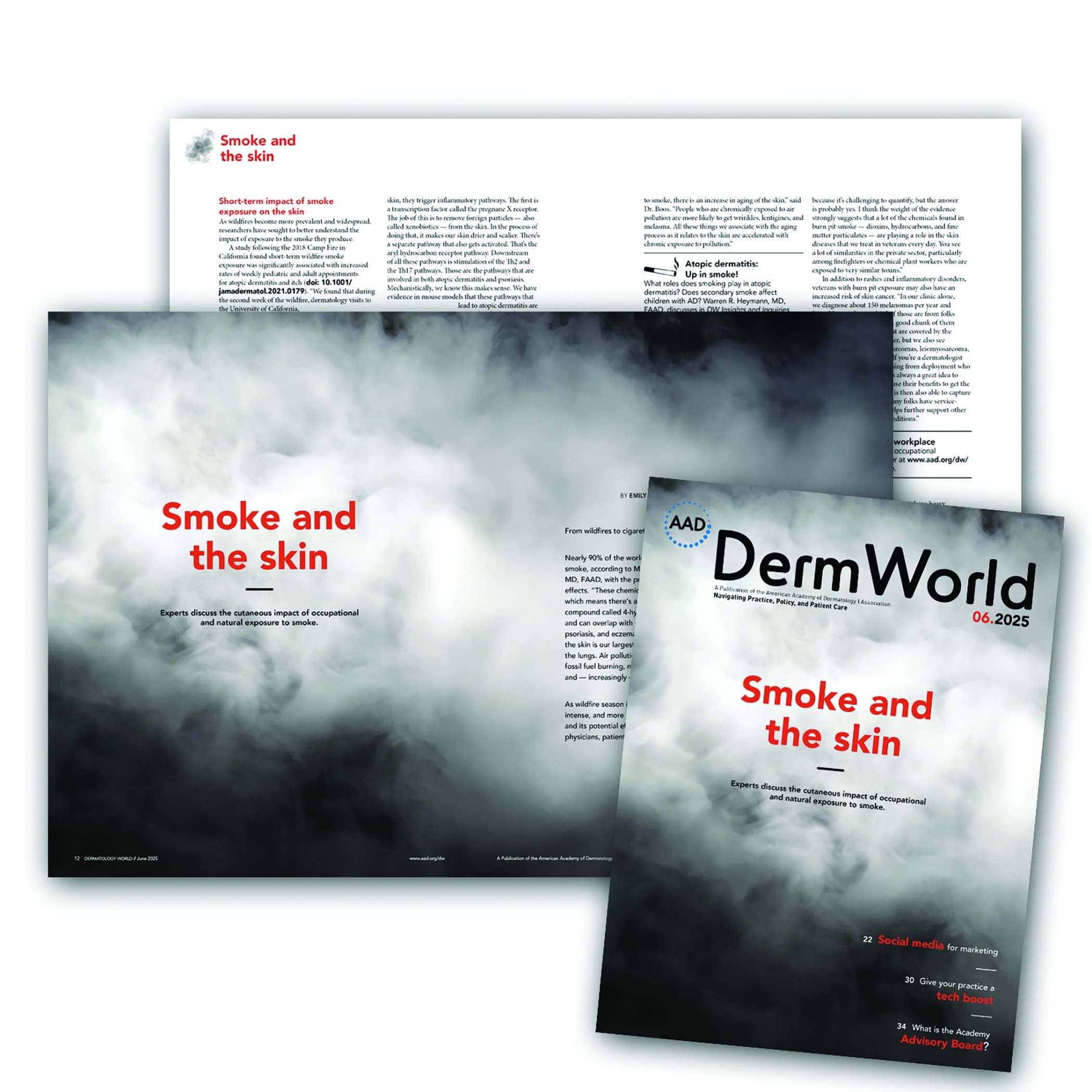 AAD’s DermWorld, June 2025, Smoke and The Skin