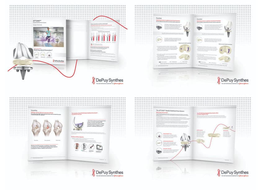 ATTUNE™ Medial Stabilized Kneed System Design Rationale