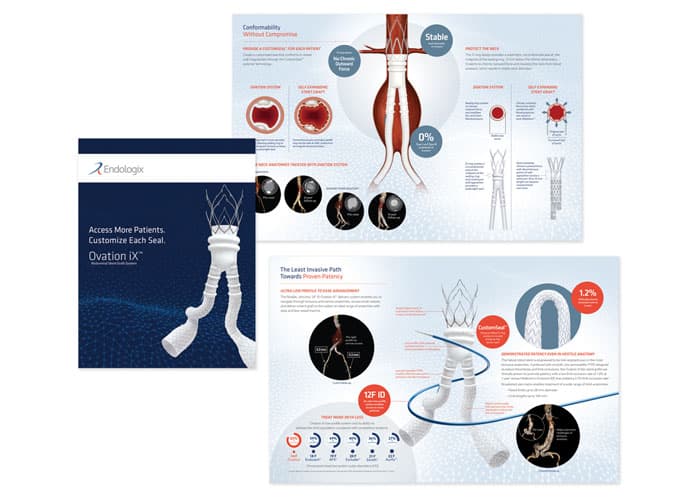 Ovation iX USA Brochure