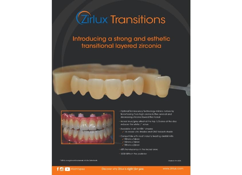 Zirlux Transitions
