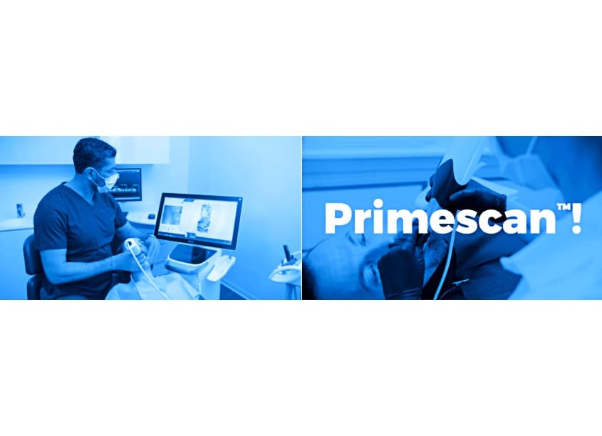 Primescan Video