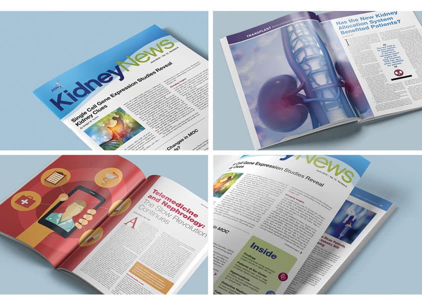 ASN Kidney News Magazine Redesign