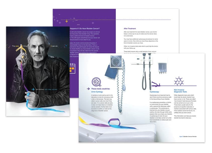 One Thing Bladder Cancer Patient Brochure