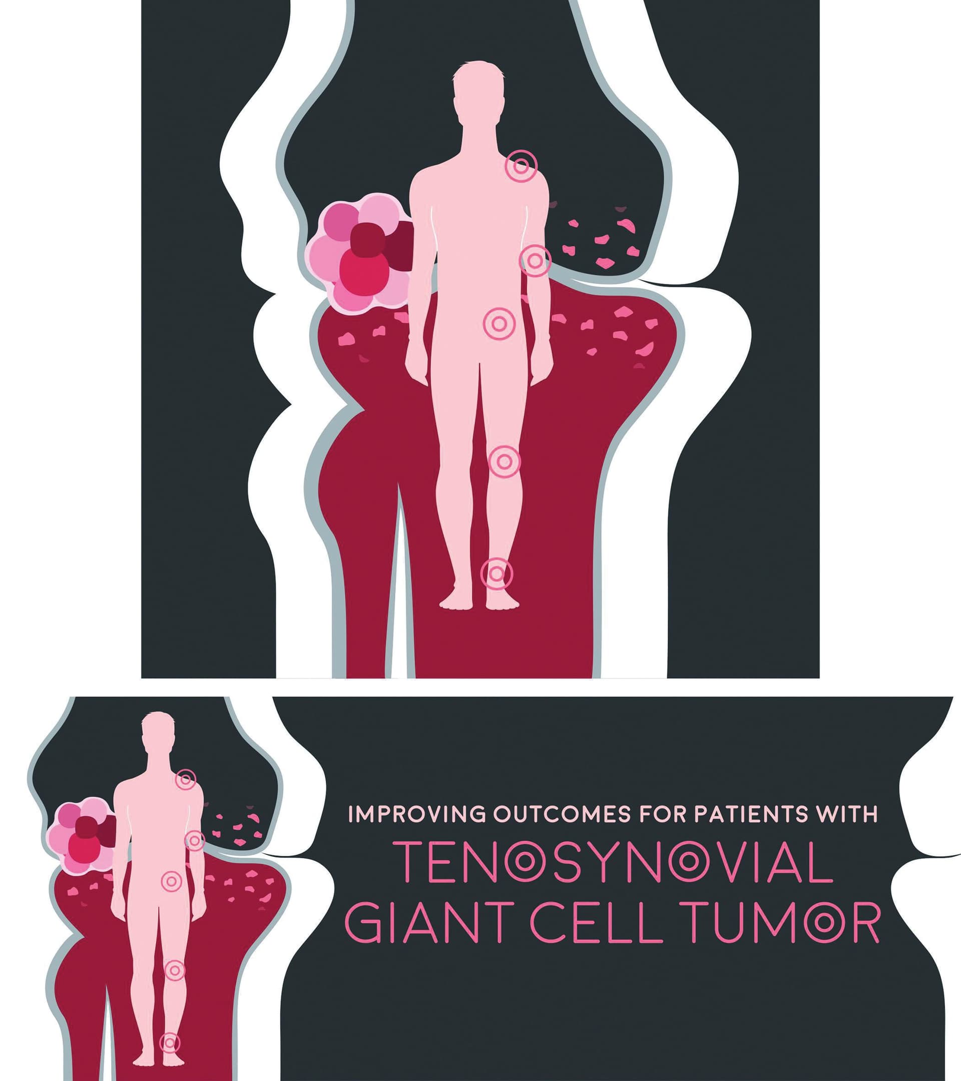 Stylized human silhouette with pink and dark red elements, highlighting tumor locations · TGCT Webinar Banner — Digital Ads/Banners design — by Hope Alison Creative, LLC — 2026 GDUSA award entry